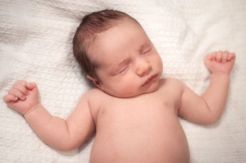 Trẻ sơ sinh bị méo đầu phải làm sao?