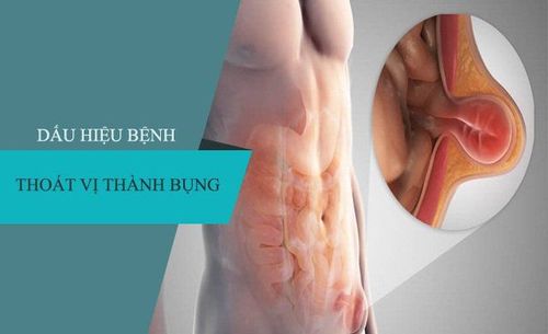 
Khi cơ thành bụng yếu hoặc hở sẽ gây ra tình trạng thoát vị thành bụng
