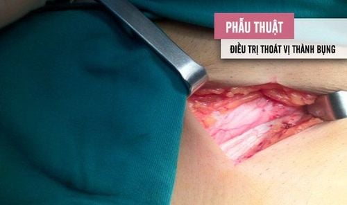 
Khối thoát vị không thể tự biến mất và chỉ có thể điều trị bằng phẫu thuật
