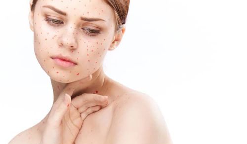 Nhận biết rubella ở người lớn