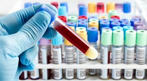 Liquid Biopsy: What you need to know