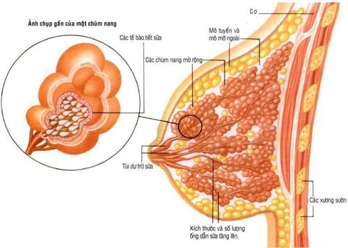 Treatment of cystic fibrosis of the breast