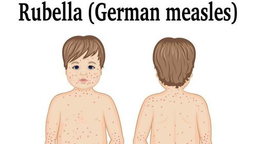 3 giai đoạn phát triển của rubella