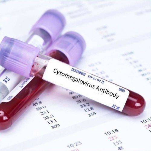 Chẩn đoán và điều trị nhiễm virus cytomegalo (CMV)