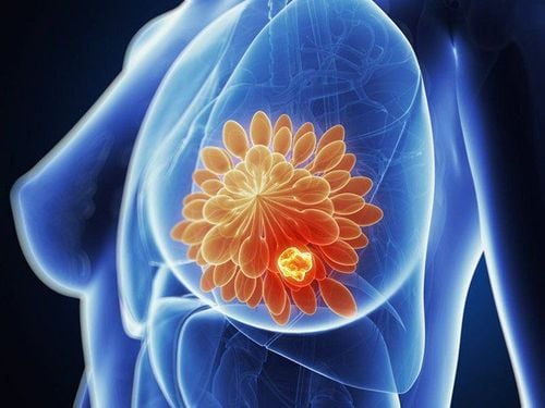 Breast Cancer Risk Factors You Can't Change