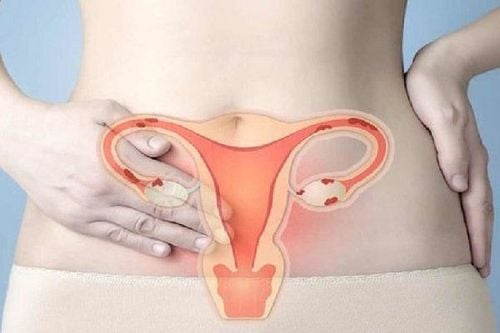 Phương pháp phát hiện sớm ung thư cổ tử cung là gì?