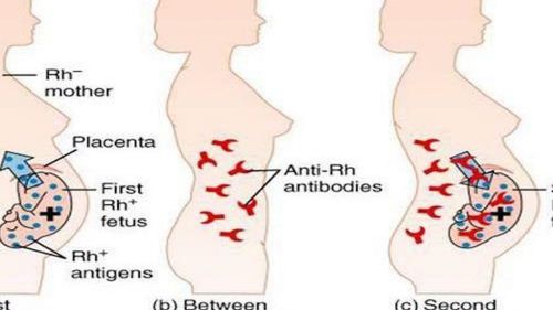 What if there is rh blood type incompatibility between mother and child?