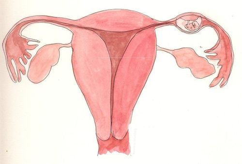 Chẩn đoán thai ngoài tử cung