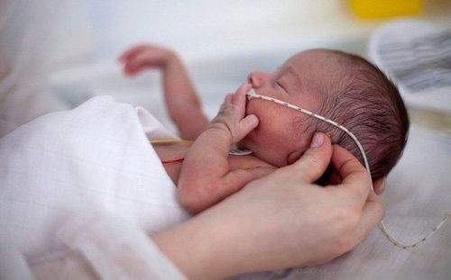 Lung problems in premature babies