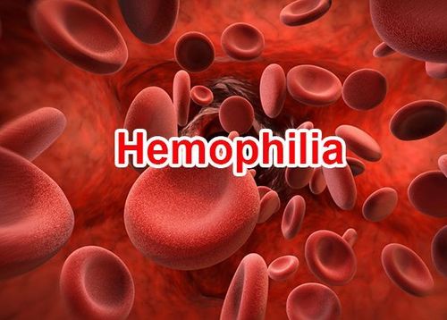 
Bệnh ưa chảy máu - Hemophilia là một trong những rối loạn đông máu thường gặp
