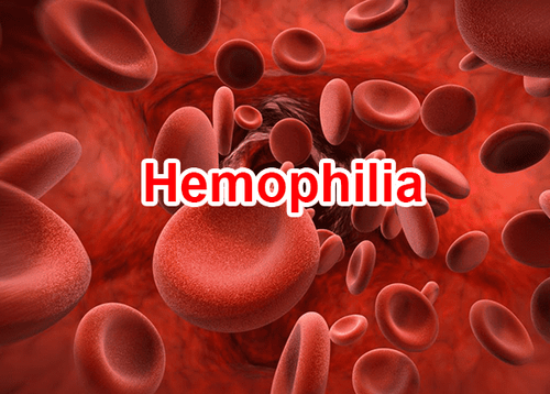 Formation of hemophilia