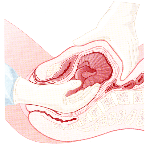 Peeling artificial vegetables after giving birth