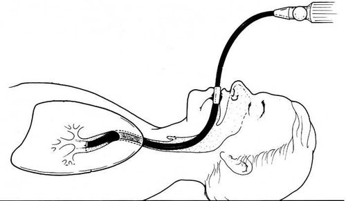 Bronchoscopy with fluorescent light