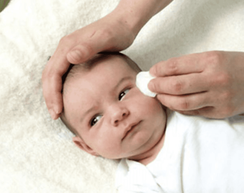 Mắt đổ ghèn, sưng mí ở trẻ sơ sinh có nguy hiểm không?