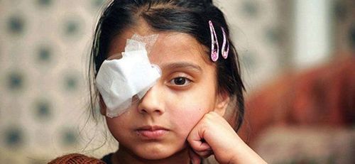 Thay băng mắt, sử dụng thuốc kháng sinh, kháng viêm sau khi phẫu thuật mắt để đảm bảo mắt có thể sớm hồi phục