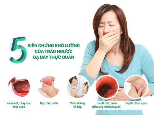 
Biến chứng của bệnh trào ngược dạ dày thực quản có thể dẫn đến ung thư
