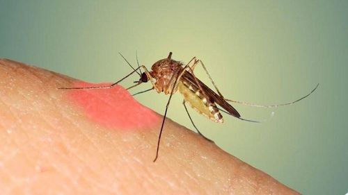 Risks of complications from dengue fever (DHF) in children