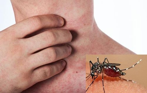 
Loài muỗi truyền bệnh sốt xuất huyết Dengue thuộc chi Aedes aegypti và Aedes albopictus hoạt động mạnh nhất là vào ban ngày
