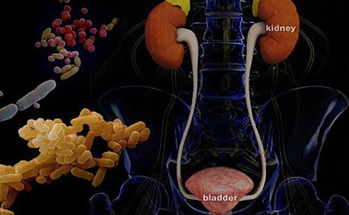 Prevention of recurrent urinary tract infections