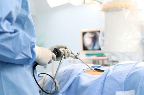 Retroperitoneal endoscopic surgery to remove ureteral stones