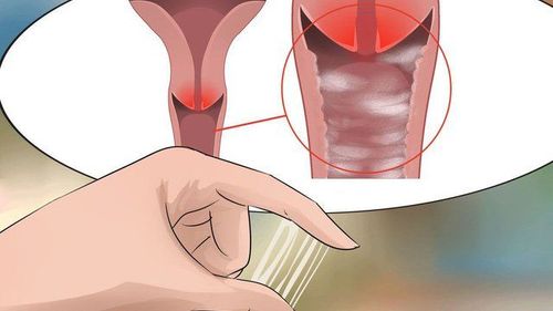 
Tiết dịch (khí hư) nhiều cảnh báo viêm âm đạo do Trichomoniasis
