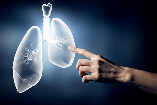 Congenital malformations of the lungs, trachea, and bronchi