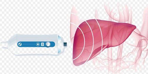 Measurement of fatty liver level after ultrasound assessment of liver fibrosis (Fibrosis)