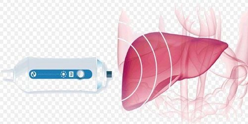 
Trong kết quả siêu âm gan thường sẽ miêu tả siêu âm gan có khối giảm âm hay không
