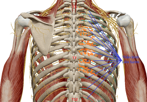 Chẩn đoán và điều trị đau dây thần kinh liên sườn