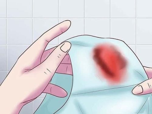 Dấu hiệu ra máu âm đạo