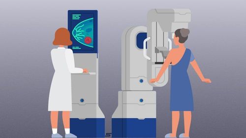 Mammography: A new step in breast cancer screening