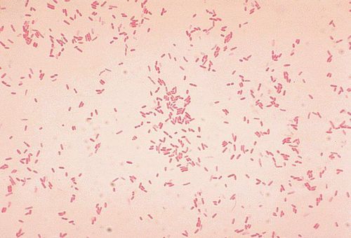 Aeromonas hydrophila có phải "vi khuẩn ăn thịt người"?