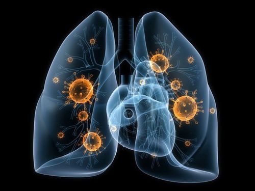 Chemotherapy for small cell lung cancer