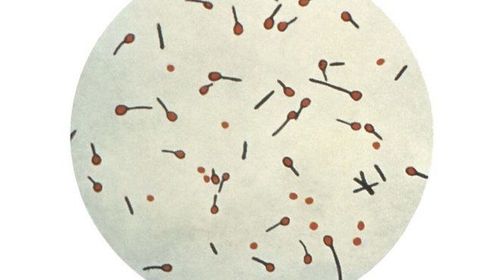 
Vi khuẩn uốn ván Clostridium tetani gây bệnh
