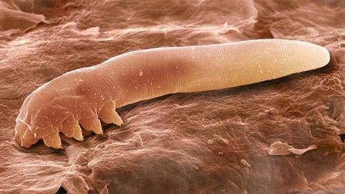 
Vi khuẩn demodex gây bệnh viêm da do demodex
