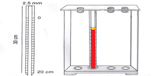 What is the erythrocyte sedimentation test for?