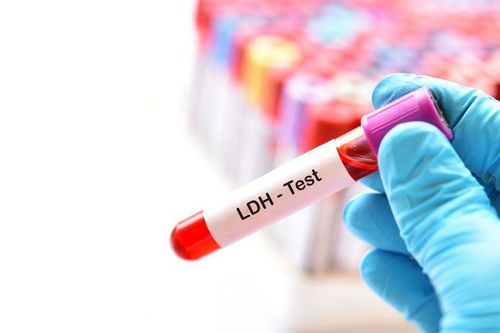 What is a quantitative LDH test and when should it be done?
