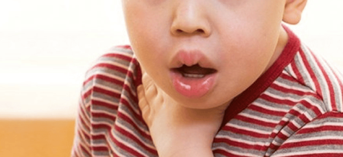 Foreign body in the airways in children: Causes, signs and complications