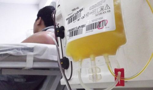 When do you need a platelet transfusion?