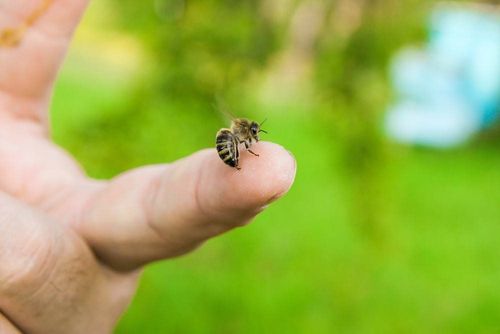 How to treat a bee sting