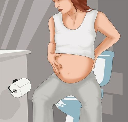 Should I push when constipated during pregnancy?