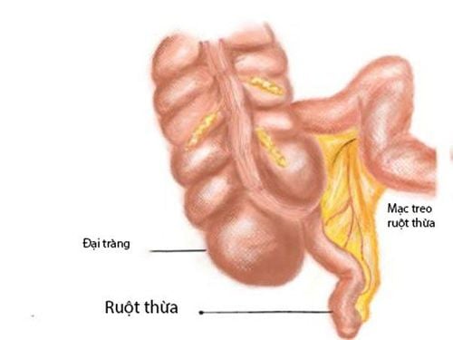 
Hình ảnh mạc treo ruột thừa
