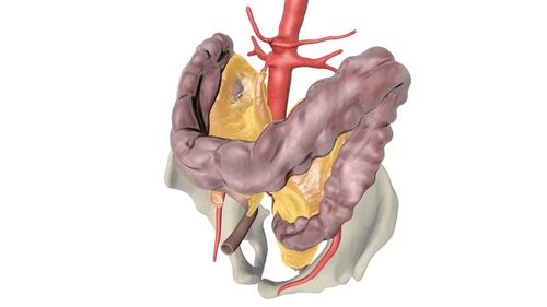 X-ray enhancement and intervention of lower mesenteric vessels