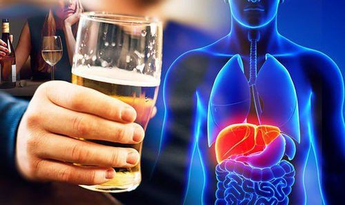 Signs of alcohol-related liver disease