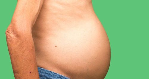 Ascites phenomenon: What you need to know