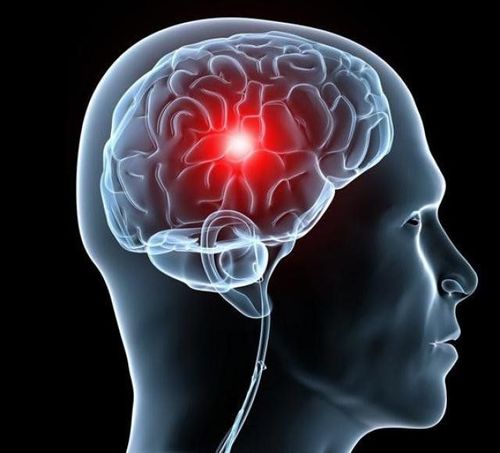 Diagnosis and treatment of raised intracranial pressure