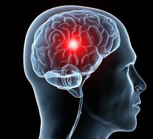 Laboratory tests for the diagnosis of raised intracranial pressure syndrome