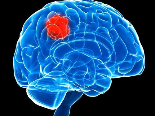 Risks and processes of brain abscess formation