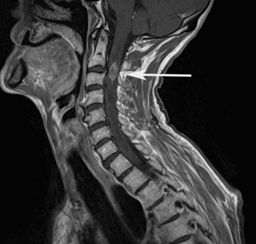 
Các cấu trúc đốt sống cổ trên phim cộng hưởng từ
