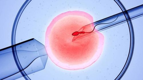 Tiêm tinh trùng vào bào tương của noãn (ICSI): Giải pháp cho các cặp vợ chồng vô sinh do yếu tố nam